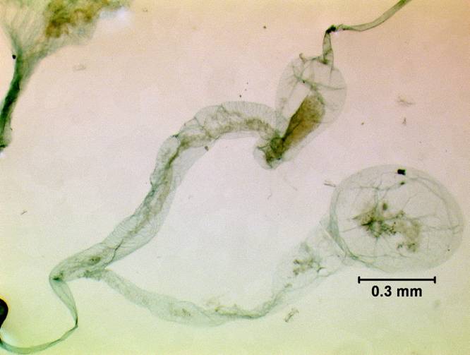 C primu 977 coil glands