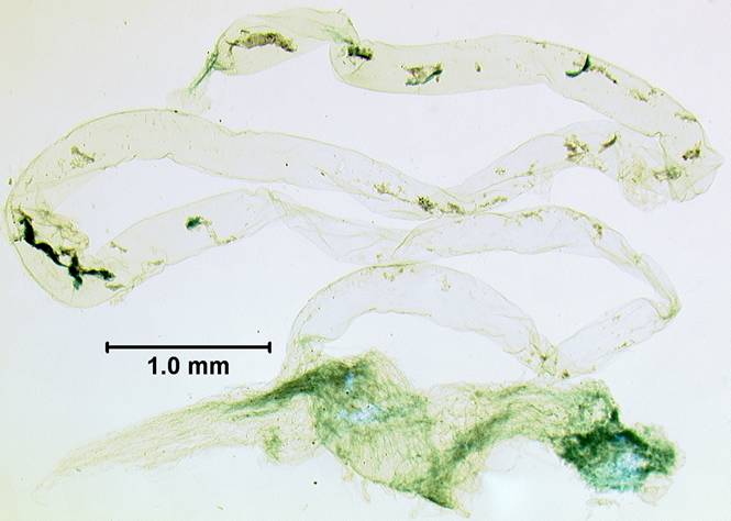 C primu 977 rectum