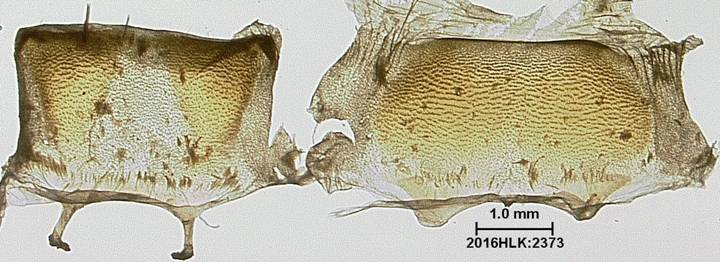 Z strig 2373 abdomen term seg