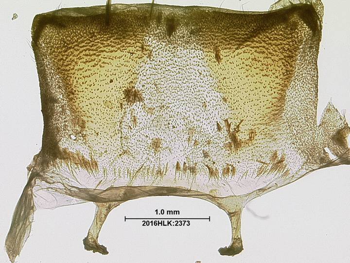 Z strig 2373 abdomen term seg dorsum